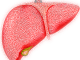 liver-dying